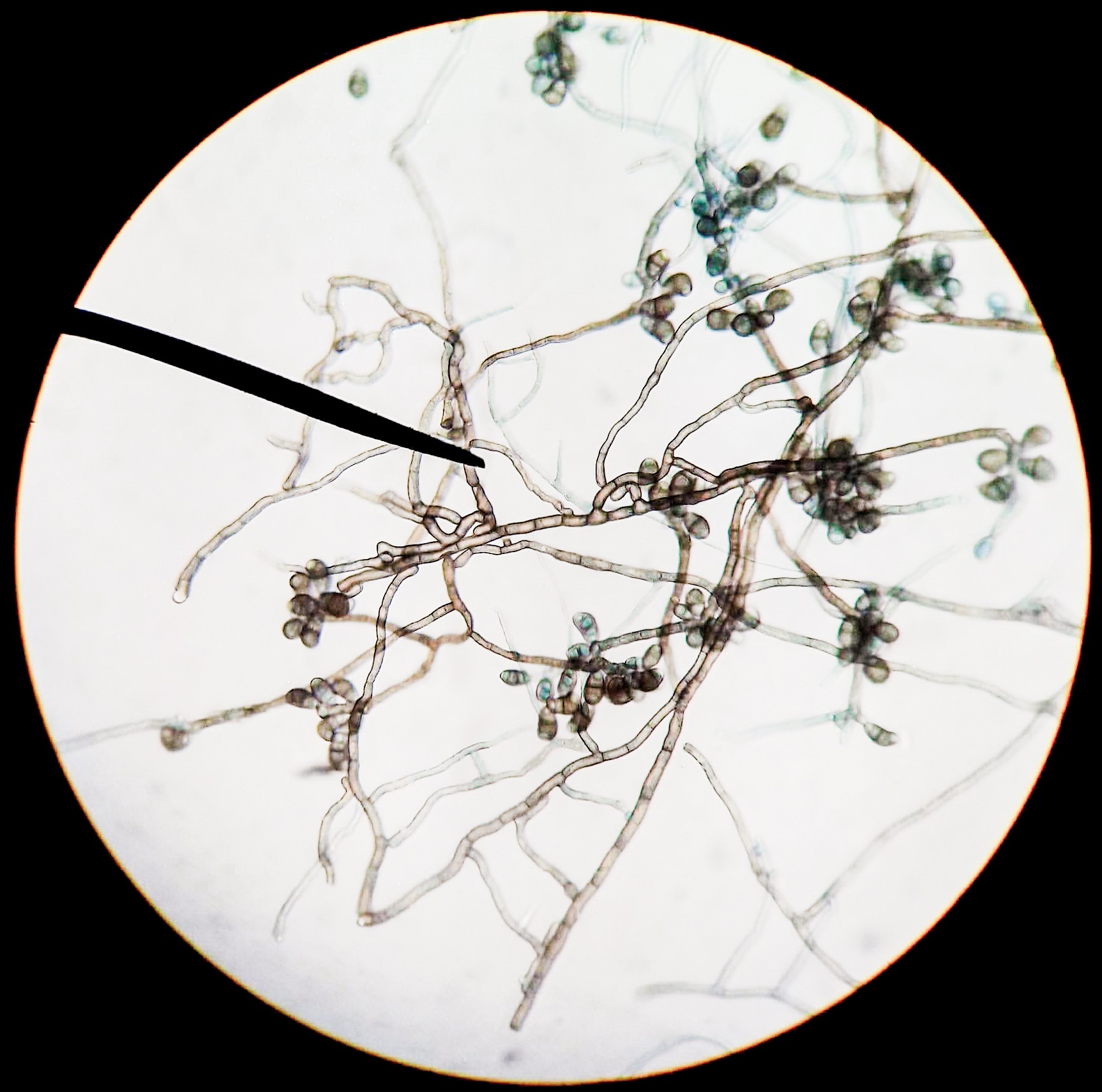 Curvularia lunata conidia under microscope